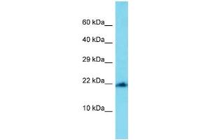 Western Blotting (WB) image for anti-Mitochondrial Ribosomal Protein L22 (MRPL22) (C-Term) antibody (ABIN2789276) (MRPL22 antibody  (C-Term))