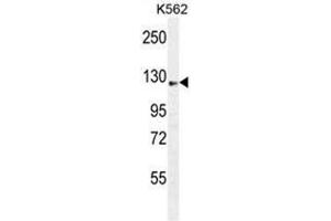 AASS Antibody (C-term) western blot analysis in K562 cell line lysates (35 µg/lane).
