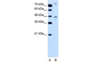 CCBP2 antibody used at 2. (CCBP2 antibody  (N-Term))