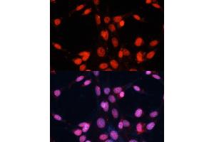 Immunofluorescence analysis of NIH/3T3 cells using FUS antibody (ABIN6127938, ABIN6140818, ABIN6140819 and ABIN7101788) at dilution of 1:100. (FUS antibody  (AA 297-526))