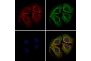 ABIN6261484 and ABIN6279421 staining Hela cells by IF/ICC. (EIF3S1 antibody  (Internal Region))