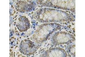 Immunohistochemistry of paraffin-embedded Rat intestine using IFI16 Polyclonal Antibody at dilution of 1:100 (40x lens). (IFI16 antibody)