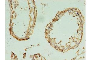 Immunohistochemistry of paraffin-embedded human testis tissue using ABIN7170641 at dilution of 1:100 (RBM11 antibody  (AA 115-278))