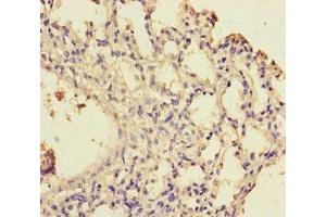 Immunohistochemistry of paraffin-embedded human lung tissue using ABIN7175770 at dilution of 1:100 (WDR54 antibody  (AA 1-334))