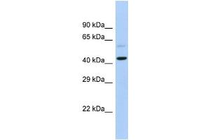 Host:  Rabbit  Target Name:  SLC16A7  Sample Type:  Fetal Heart lysates  Antibody Dilution:  1. (SLC16A7 antibody  (C-Term))