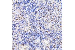 PDCD10 antibody  (AA 1-212)