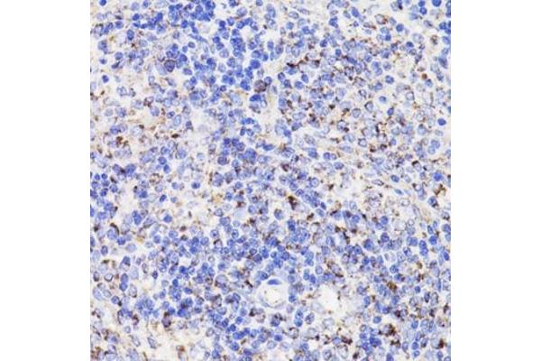 PDCD10 antibody  (AA 1-212)