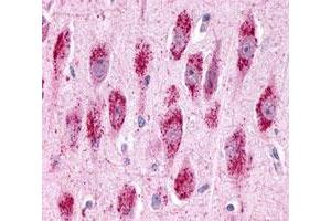 Immunohistochemistry (Formalin/PFA-fixed paraffin-embedded sections) of human brain, neurons and glia with GPR3 polyclonal antibody . (GPR3 antibody  (2nd Extracellular Domain))