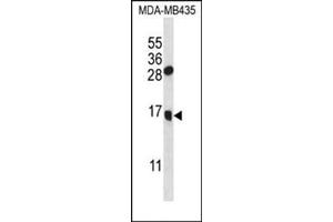 Western blot analysis in MDA-MB435 cell line lysates (35 ug/lane) using GNLY Antibody (C-term) Cat. (GNLY antibody  (N-Term))