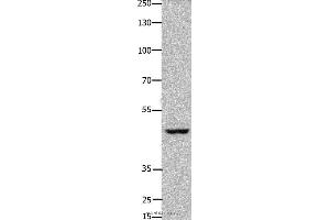 Western blot analysis of Hela cell, using FOXD3 Polyclonal Antibody at dilution of 1:450