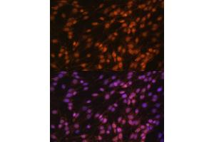 Immunofluorescence analysis of C6 cells using FUBP1 antibody (ABIN6130392, ABIN6140802, ABIN6140804 and ABIN6221231) at dilution of 1:100. (FUBP1 antibody  (AA 302-644))