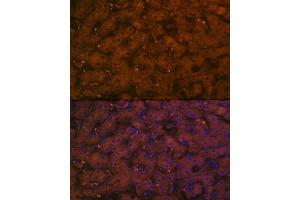 Immunofluorescence analysis of human liver using Complement C4A Rabbit mAb (ABIN7266481) at dilution of 1:100 (40x lens). (C4A antibody)