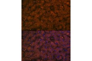 Immunofluorescence analysis of human liver using Complement C4A Rabbit mAb (ABIN7266481) at dilution of 1:100 (40x lens). (C4A antibody)