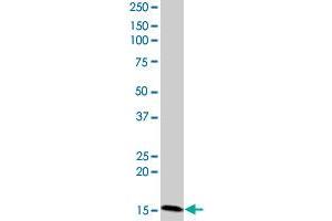 CIDEC monoclonal antibody (M07), clone 2E2. (CIDEC antibody  (AA 53-141))