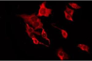 ABIN6277679 staining HT29 by IF/ICC. (Serotonin Receptor 3A antibody  (Internal Region))