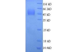 Syndecan 1 (SDC1) (AA 23-257) protein (His tag) (Syndecan 1 Protein (SDC1) (AA 23-257) (His tag))