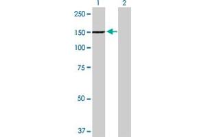 Western Blot analysis of TYK2 expression in transfected 293T cell line by TYK2 MaxPab polyclonal antibody. (TYK2 antibody  (AA 1-1187))
