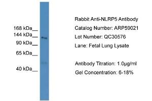 WB Suggested Anti-NLRP5  Antibody Titration: 0.