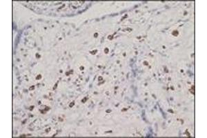 Immunohistochemistry (IHC) image for anti-CD163 (CD163) (N-Term) antibody (ABIN870405) (CD163 antibody  (N-Term))
