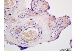 Formalin-fixed and paraffin embedded human placenta labeled with Anti-ABCG1 Polyclonal Antibody, Unconjugated (ABIN673719) at 1:200 followed by conjugation to the secondary antibody and DAB staining. (ABCG1 antibody  (AA 561-678))