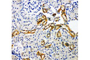 Anti-NADPH oxidase 4 antibody, IHC(P) IHC(P): Rat Kidney Tissue