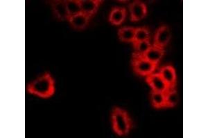 Immunofluorescent analysis of GBL staining in MCF7 cells. (GBL antibody)