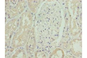Immunohistochemistry of paraffin-embedded human kidney tissue using ABIN7170263 at dilution of 1:100 (SLC46A3 antibody  (AA 26-73))