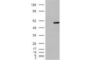 Image no. 2 for anti-Fumarate Hydratase (FH) (Internal Region) antibody (ABIN374767) (FH antibody  (Internal Region))