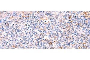 Immunohistochemistry of paraffin-embedded Human tonsil tissue using FUCA2 Polyclonal Antibody at dilution of 1:70(x200) (FUCA2 antibody)
