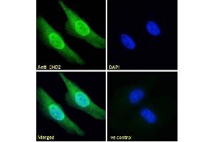 ABIN185287 Immunofluorescence analysis of paraformaldehyde fixed HeLa cells, permeabilized with 0. (EHD2 antibody  (C-Term))