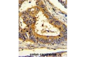 Immunohistochemistry (IHC) image for anti-SREBF chaperone (SCAP) antibody (ABIN3003807) (SREBF chaperone antibody)