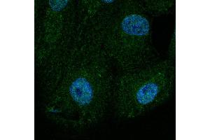 Immunofluorescence - anti-BAX Ab at 1/100 dilution in NHl/3T3 cells, cells were fixed with methanol and permeabilized With 0. (BAX antibody  (N-Term))