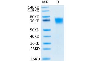 Human FGFR3 alpha (IIIc) on Tris-Bis PAGE under reduced conditions.