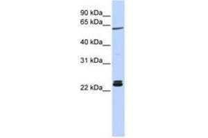 Image no. 1 for anti-H1 Histone Family, Member 0 (H1F0) (AA 36-85) antibody (ABIN6741265)