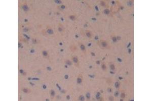 Figure. (Fascin 2 antibody  (AA 8-278))