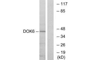 Western blot analysis of extracts from COLO cells, using DOK6 antibody. (DOK6 antibody  (Internal Region))