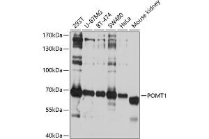 Western blot analysis of extracts of various cell lines, using POMT1 antibody (ABIN6132825, ABIN6145953, ABIN6145954 and ABIN6214473) at 1:1000 dilution.