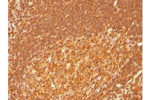 Image no. 1 for anti-Major Histocompatibility Complex, Class II, DR beta 1 (HLA-DRB1) antibody (ABIN6186381) (HLA-DRB1 antibody)