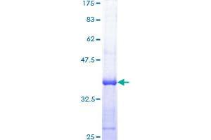 RPA1 Protein (AA 1-110) (GST tag)