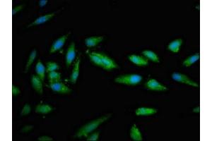 Immunofluorescent analysis of Hela cells using ABIN7171253 at dilution of 1:100 and Alexa Fluor 488-congugated AffiniPure Goat Anti-Rabbit IgG(H+L) (STXBP1 antibody  (AA 245-594))