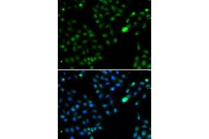 Immunofluorescence analysis of HeLa cells using FKBP3 antibody. (FKBP3 antibody  (AA 1-224))