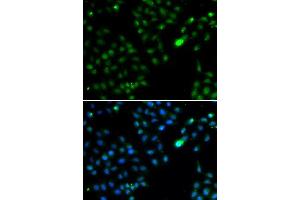 Immunofluorescence analysis of HeLa cells using FKBP3 antibody. (FKBP3 antibody  (AA 1-224))