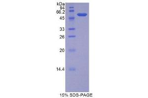 SDS-PAGE (SDS) image for Lipase, Bile Salt Dependent (AA 117-361) protein (His tag,GST tag) (ABIN1877460)