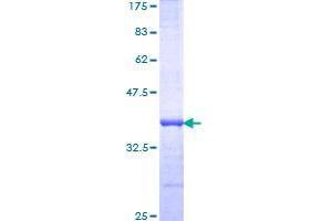 Image no. 1 for Ring Finger Protein 219 (RNF219) (AA 1-95) protein (GST tag) (ABIN1318352) (RNF219 Protein (AA 1-95) (GST tag))