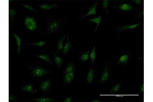 Immunofluorescence of purified MaxPab antibody to TBC1D1 on HeLa cell. (TBC1D1 antibody  (AA 1-1168))