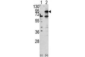 Western blot analysis of CPT1B antibody and 293 cell lysate either nontransfected (Lane 1) or transiently transfected with the CPT1B gene (2).