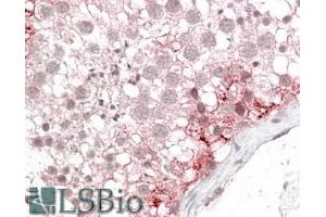 ABIN302166 (3. (CX3CL1 antibody  (Internal Region))