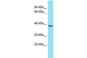 Host: Rabbit Target Name: TMEM121 Sample Type: ACHN Whole Cell lysates Antibody Dilution: 1. (TMEM121 antibody  (N-Term))