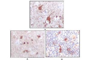 Immunohistochemical analysis of paraffin-embedded human brain (A) and human thymus tissues (B), showing cytoplasmic localization using S100B mouse mAb with DAB staining. (S100B antibody)