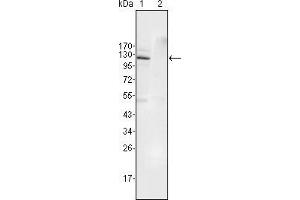 Western blot analysis using EphB4 mouse mAb against Jurkat (1) and HEK293 (2) cell lysate. (EPH Receptor B4 antibody  (AA 562-612))